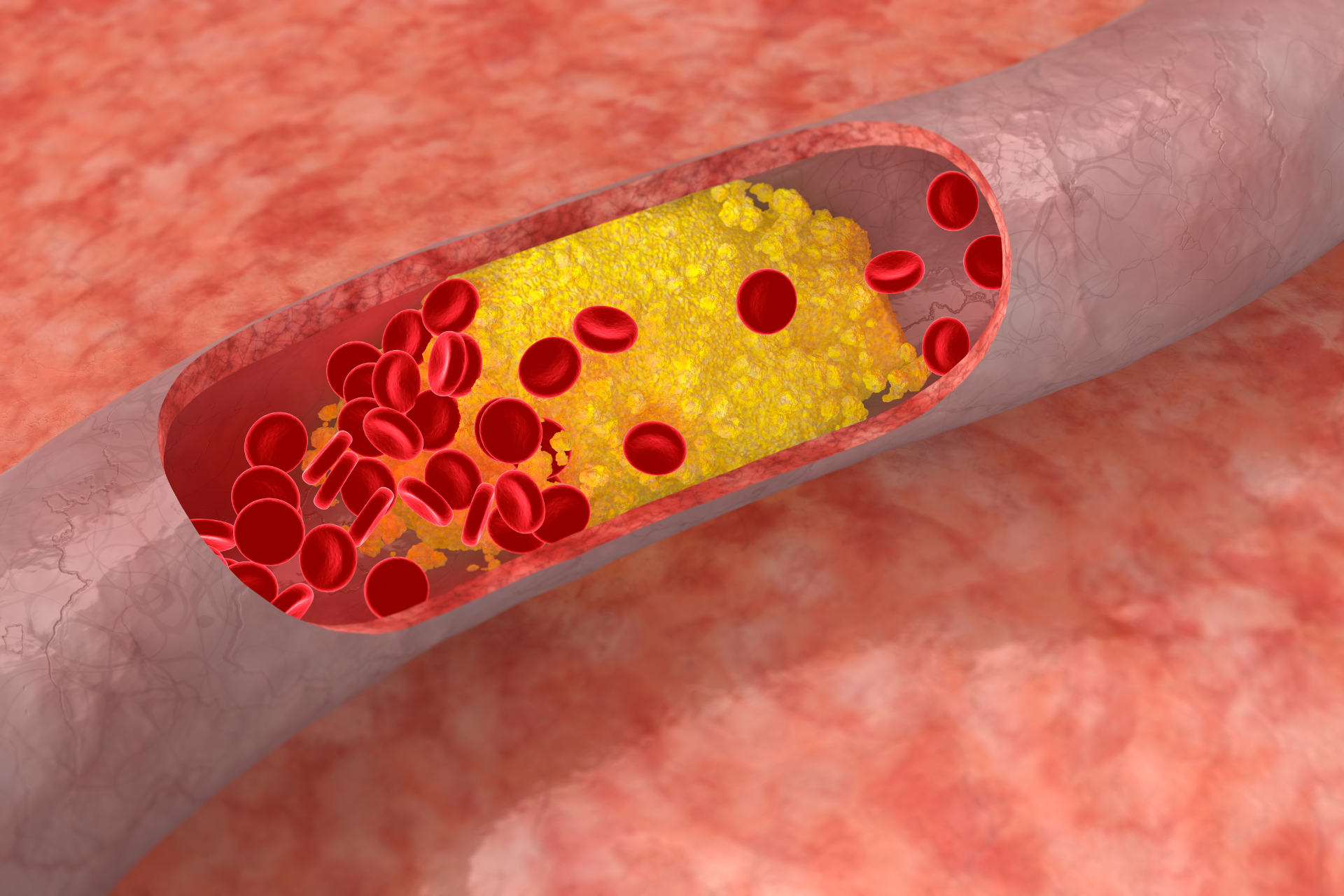 cardiovascular health